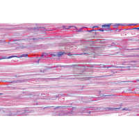 Prép. Micro. Muscle cardiaque