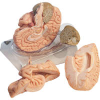 Cerveau en 4 parties Somso®