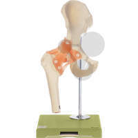 Modèle fonctionnel de l'articulation de la hanche